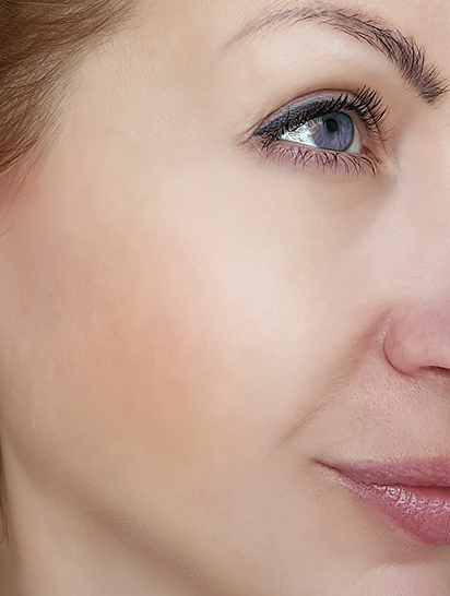 Microneedling Before and After One Treatment, What to Expect