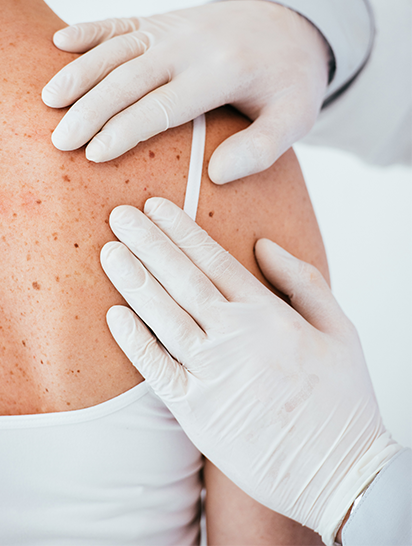 What are the best ways to prevent skin cancer?