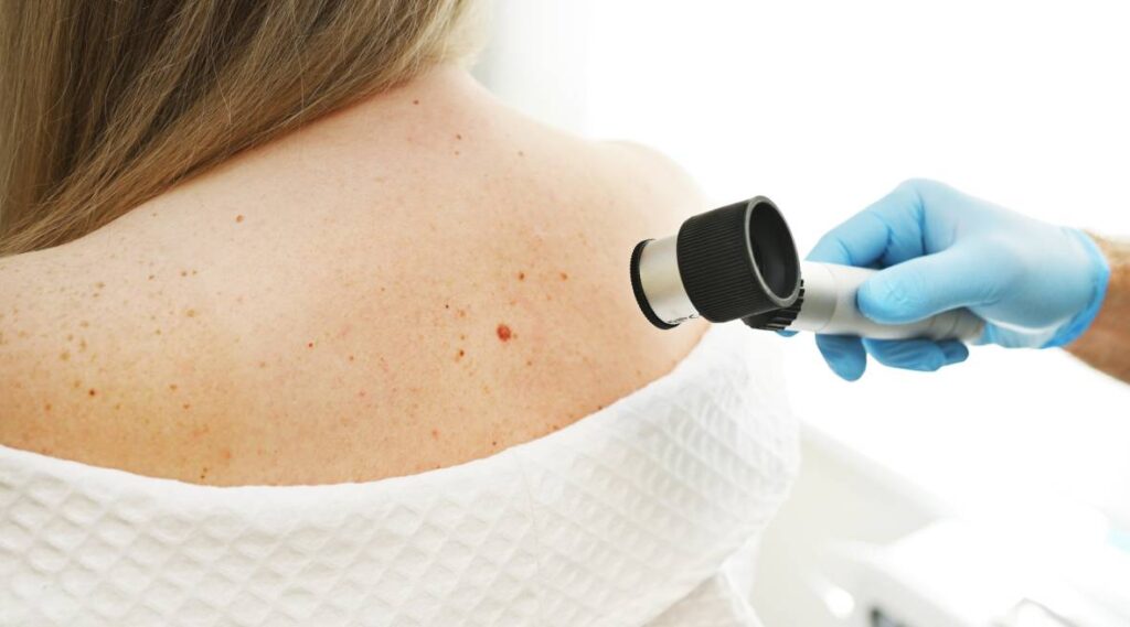 SKIN CANCER AWARENESS: PRIORITIZE YOUR SKIN’S PROTECTION Thumbnail